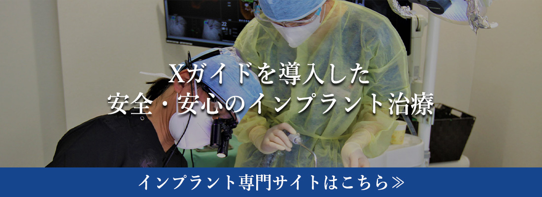 Xガイドを導入した安全・安心のインプラント治療